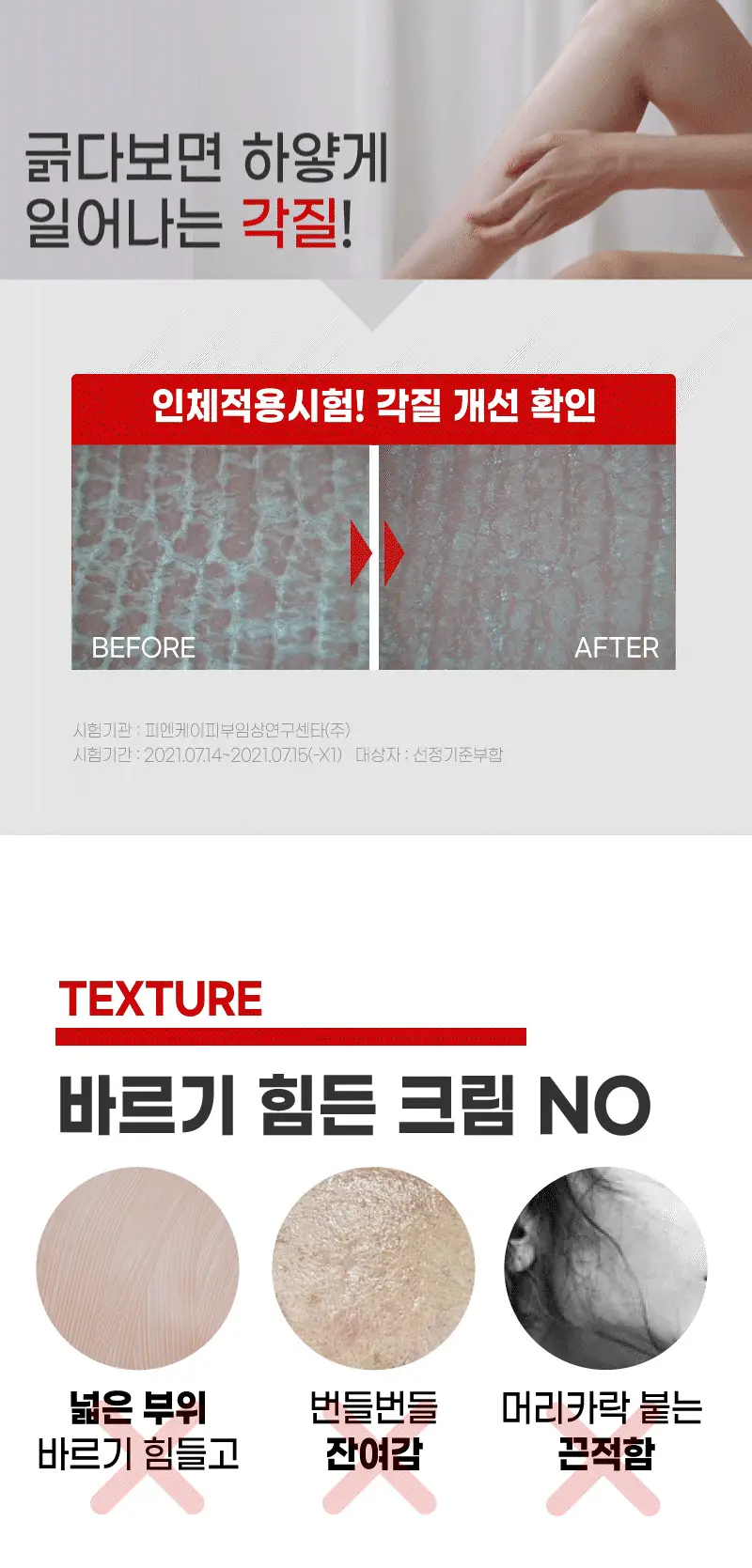 [가려움기능성] 일리윤 레드이치 케어크림 330ML 기획(오일 20ml 증정) 상세페이지 24